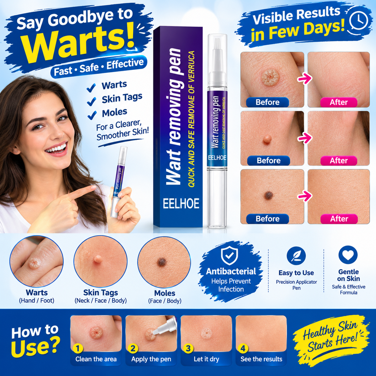 🩹 Wart Remover Gel Pen – Complete Shopify Product Listing
