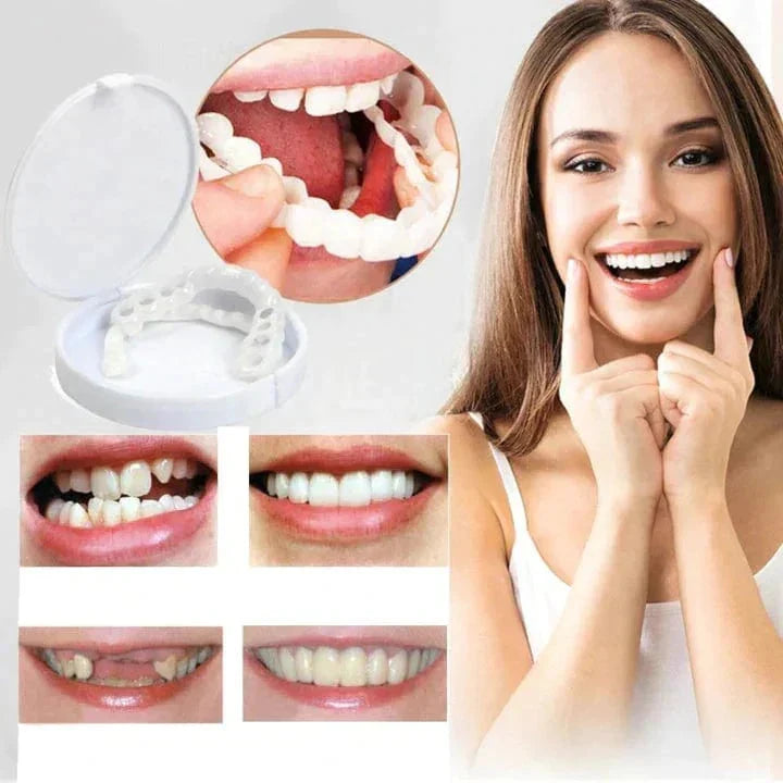 Snap-On Smile Veneers | Instant Cosmetic Teeth Cover for a Brighter-Looking Smile